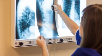 Что показывает рентген грудной клетки?