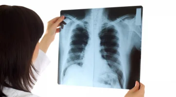 Особенности рентгенодиагностики