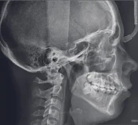 Центр диагностики челюстно–лицевой области Пикассо на Носовихинском шоссе Фотография 2