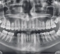 Центр диагностики челюстно–лицевой области Пикассо в Малом Кисельном переулке Фотография 2