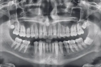 Центр диагностики челюстно-лицевой области Пикассо на Октябрьском проспекте Фотография 2