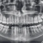 Центр диагностики челюстно–лицевой области Пикассо на Волоколамском шоссе Фотография 6
