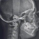 Центр диагностики челюстно–лицевой области Пикассо на Волоколамском шоссе Фотография 4